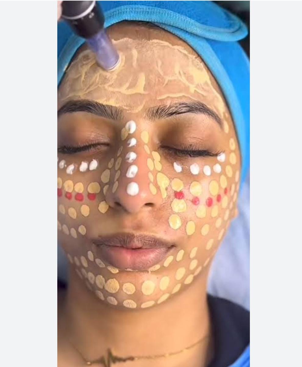 Glutathione IV Drip